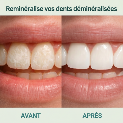 ÉMAÏA - Chewing-Gum Reminéralisant